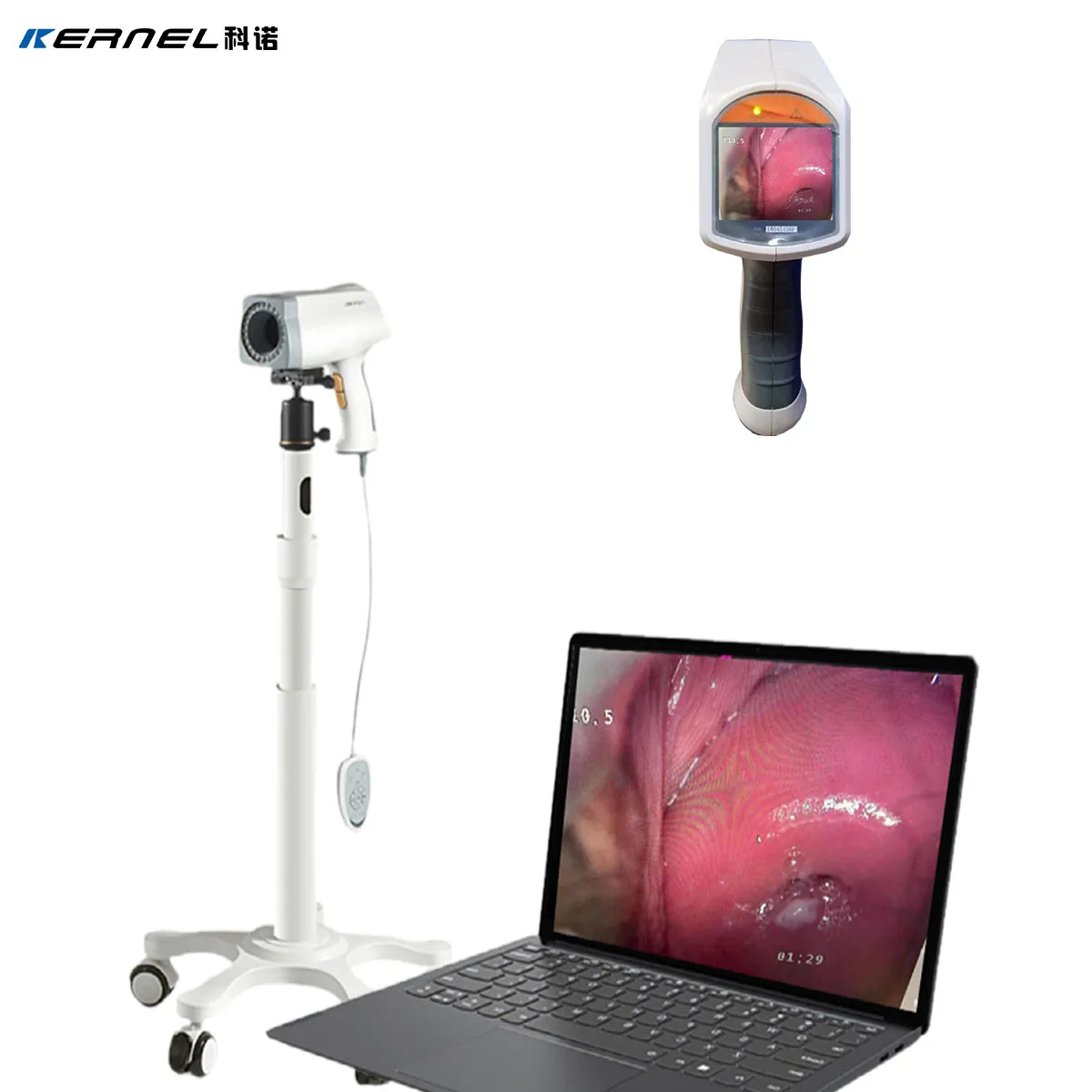 CE Cleared Digital Video Colposcope with Powerful Software Medical Mobile HD Digital Video Colposcope for Gynecology KN-2200