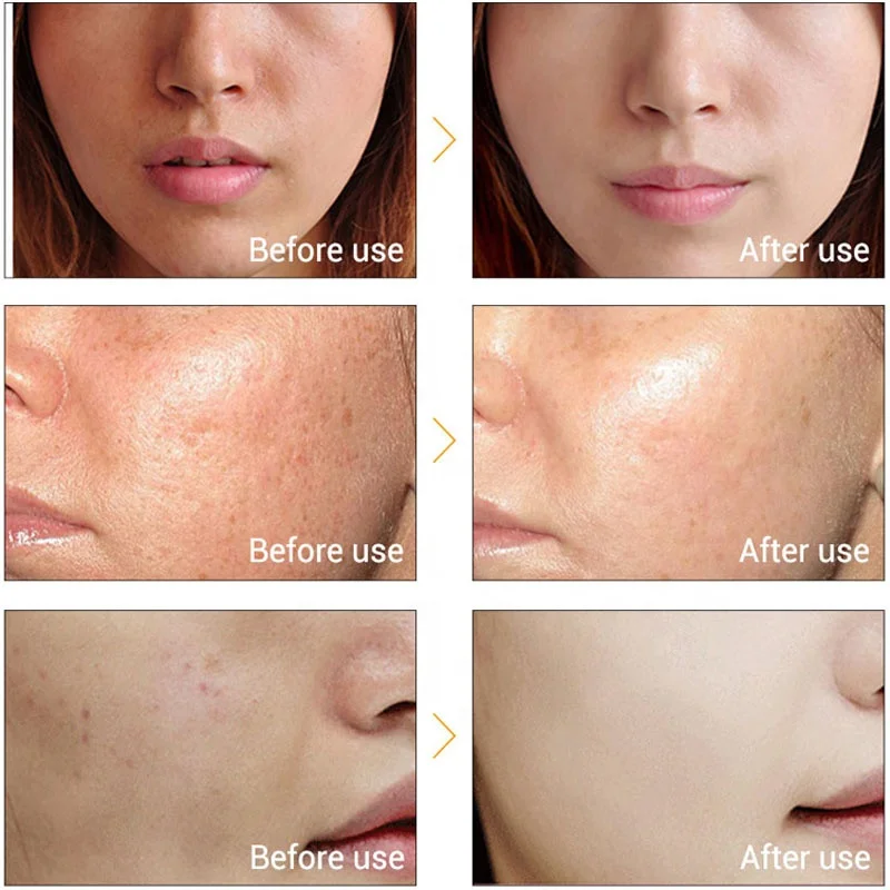 Private Label Vitamin C Kojic Acid Skincare Glutathione Serum Skin Whitening Facial Serum For Dark Spots Remover