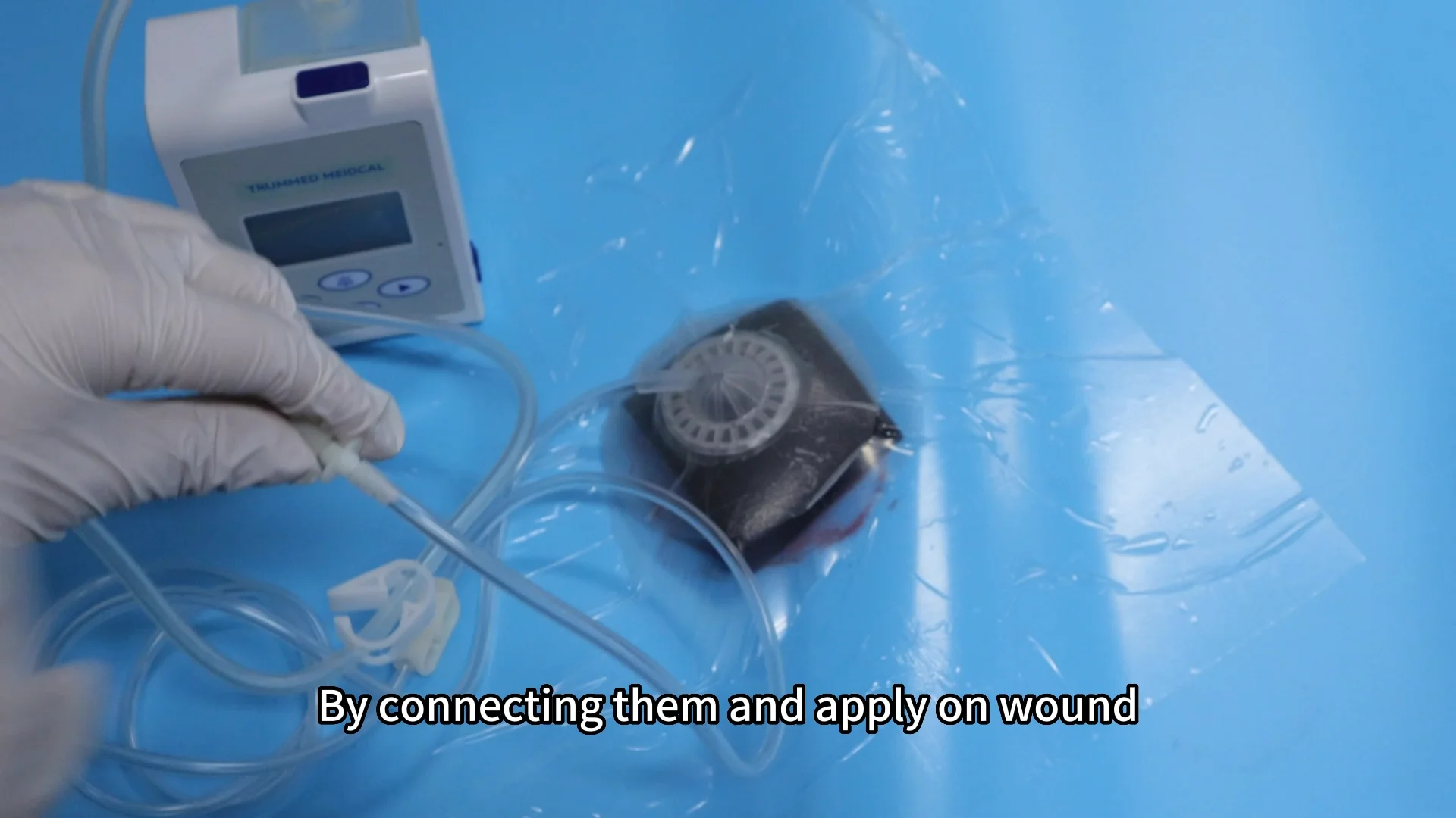 Trummed Medical Negative Pressure Wound Therapy Npwt Vac Therapy System ...