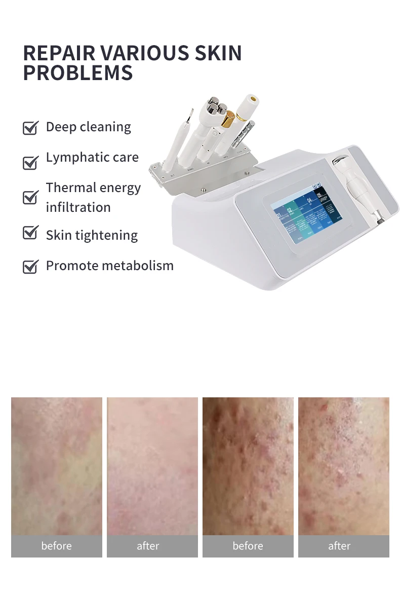 Anti-Aging Face Slimming Device Beauty Equipment for Facial Care