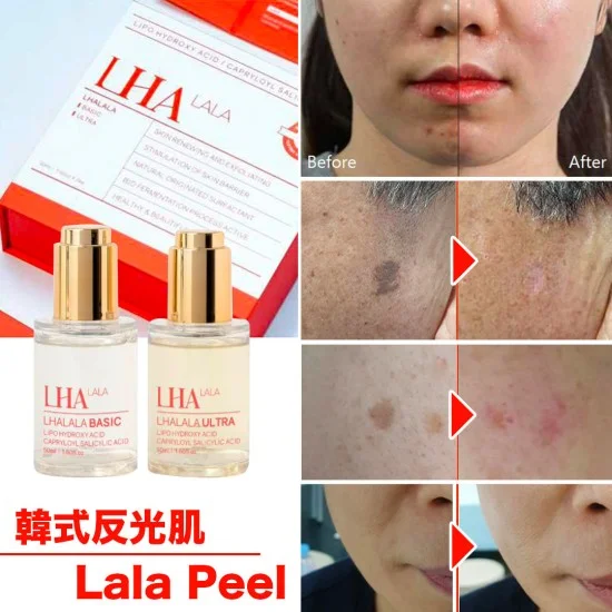 2025 New Product Korean LHA LALA Peel - Skin Peeling Solution