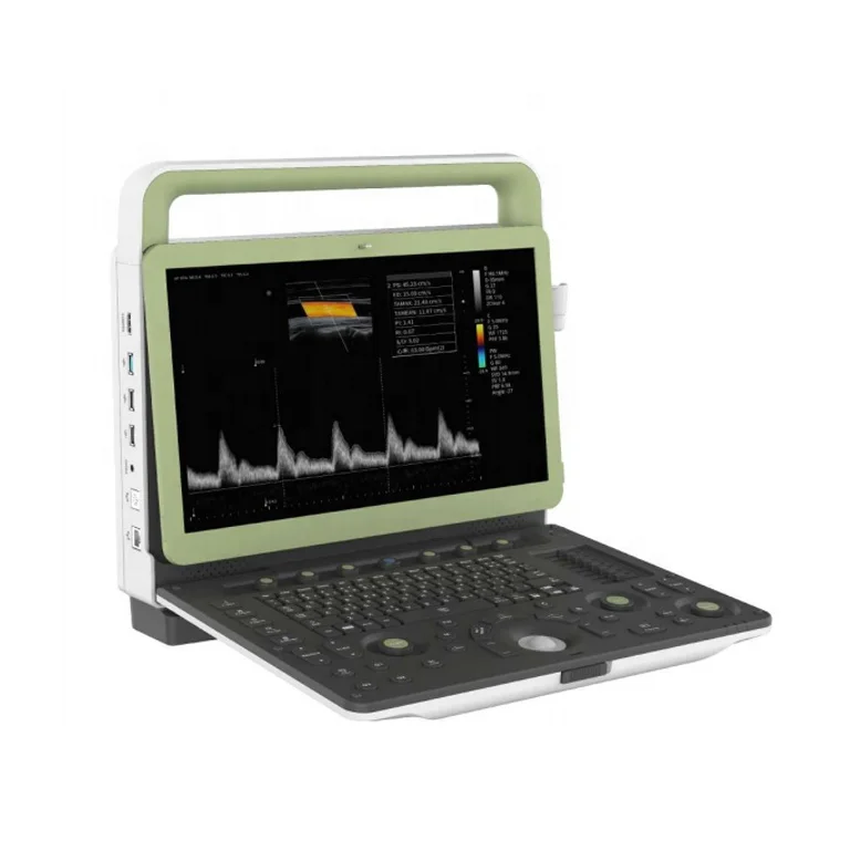 Medsinglong Ultrasound Scanner Machine Ecocardiografo Portatil Human Pregnancy Color Doppler Portable 4D Ultrasound Machine
