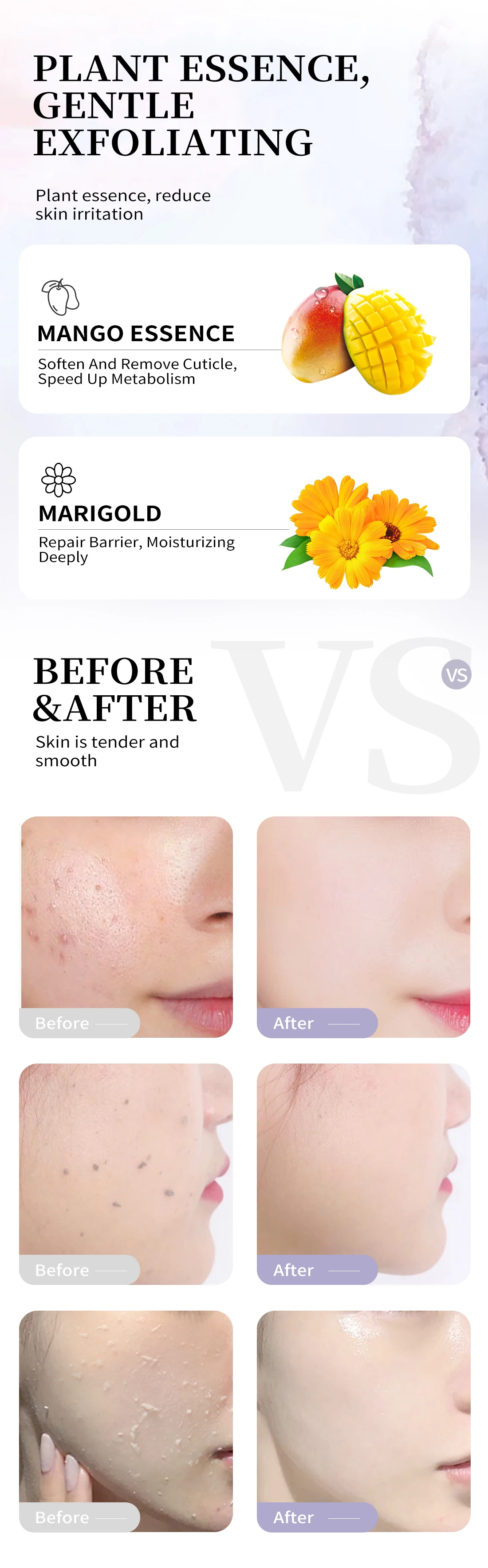 Rtopr Official Store Exfoliating Cream Skin Care Whitening Moisturizer