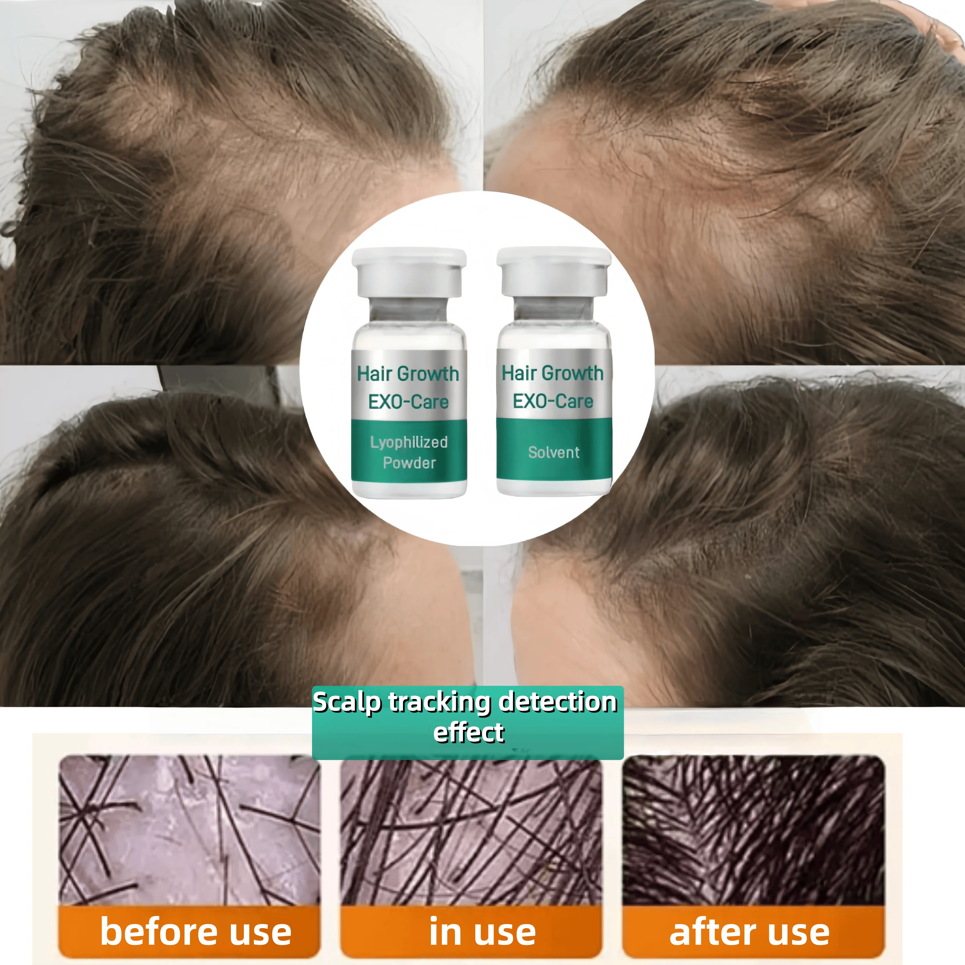 ghk-cu hair follicle stimulation 2billion Exos Growth Lyophilized Powder Professional Anti Hair Loss Regrowth Treatment Solution Determination of sequence and TESAMORELIN Quantity:2 Bottles