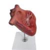 B026E canine filarial Pathological Model