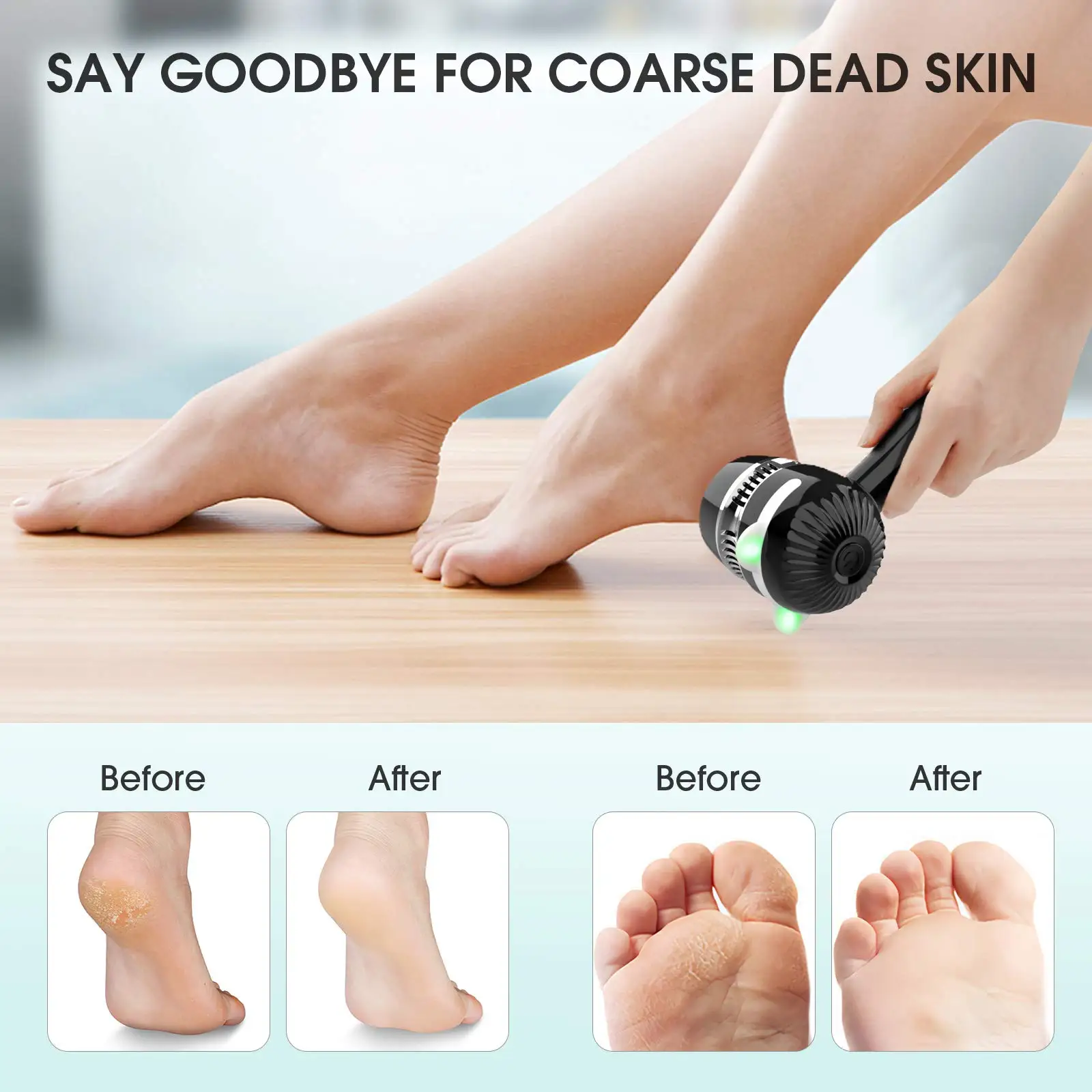 Popular Foot File Vacuum Callus Remover Rechargeable Foot Callus