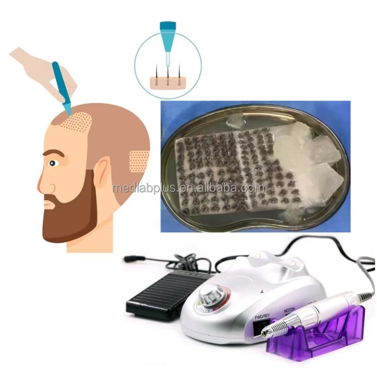 Manual Power Source Follicular Unit Extraction (FUE) Punch Machine Choi Implantor Choi Pen Hair Transplant Instruments
