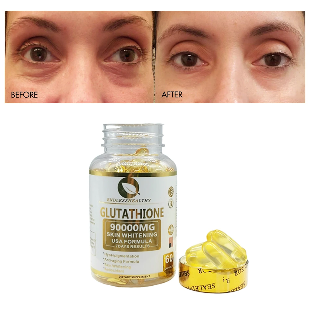 best glutathione for skin whitening in usa Best Selling 90000mg Glutathione Collagen Capsule Skin Whitening Natural Usa Formula Brighten Beauty Skin| Alibaba.com
