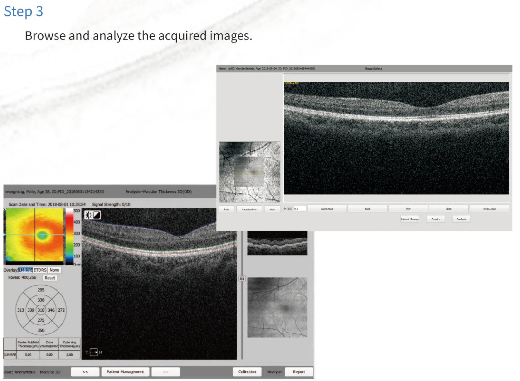 Hot Selling Ophthalmic Medical Equipment OCT-500 Ophthalmic Scanner Optical Coherence Tomography