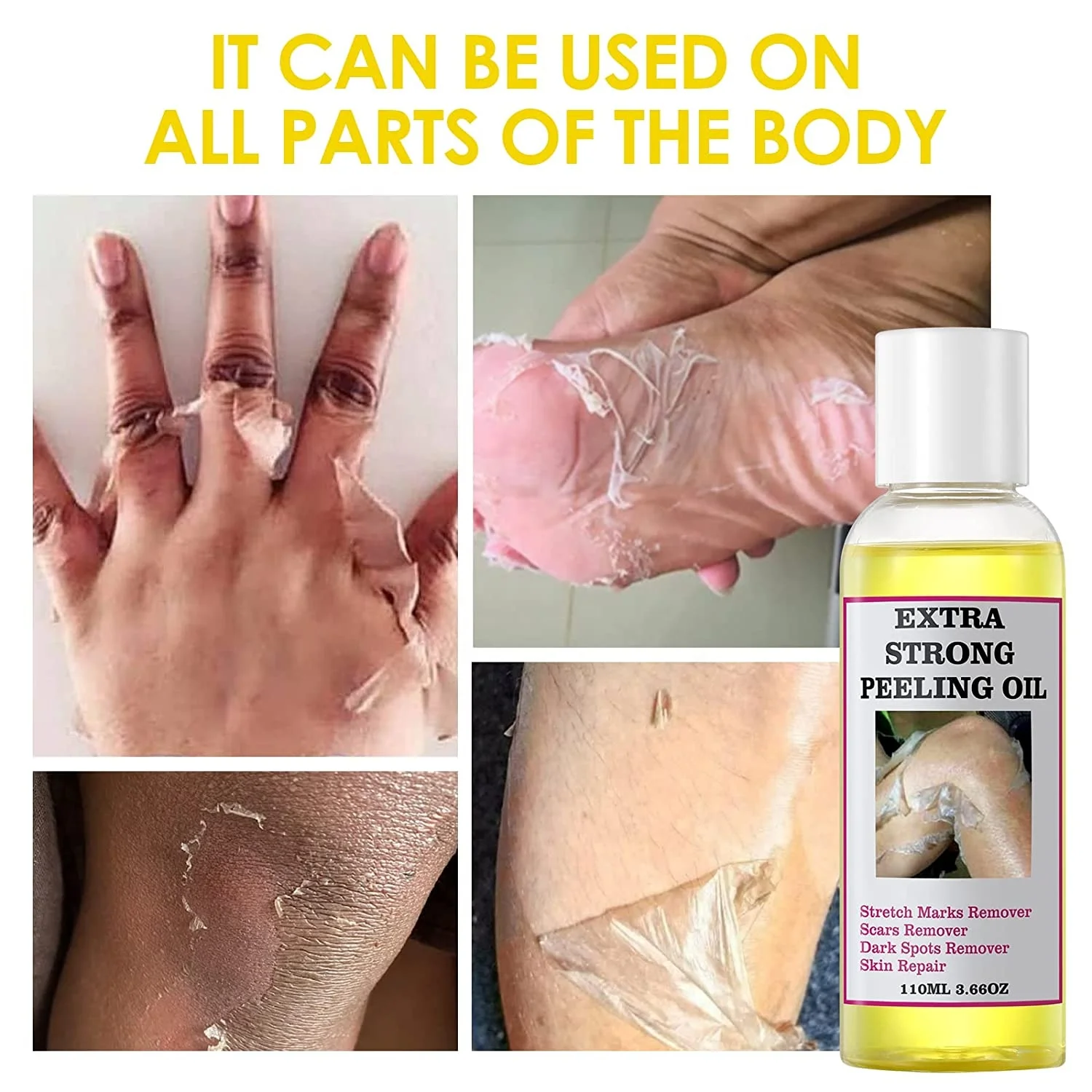 Private Label Extra Strong Peeling Oil Scar Remove Stretch Marks Whitening Yellow Peeling Oil