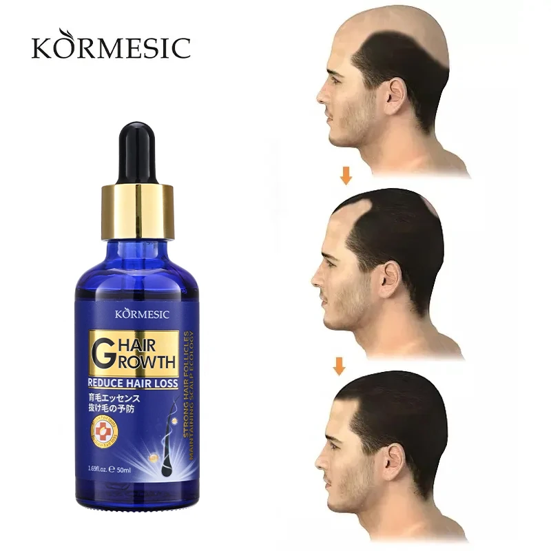 OEM ODM D Professional Nature Hair Care Deep Conditioning Hydrating Repair Large Bottle Hair Growth Oil 50ml