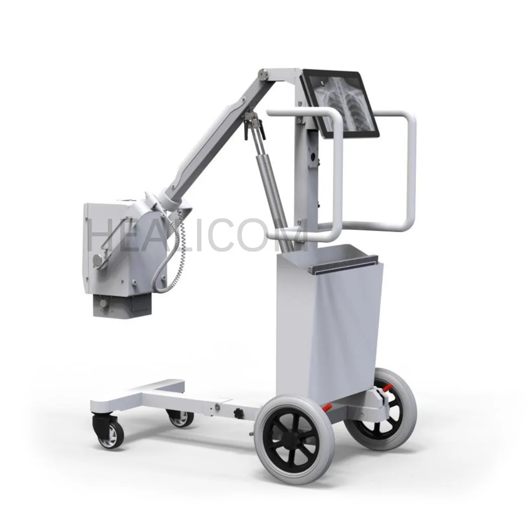 Highest Cost-effective HEALICOM HFX-08D Touch Screen Portable Mobile DR X-ray Machine