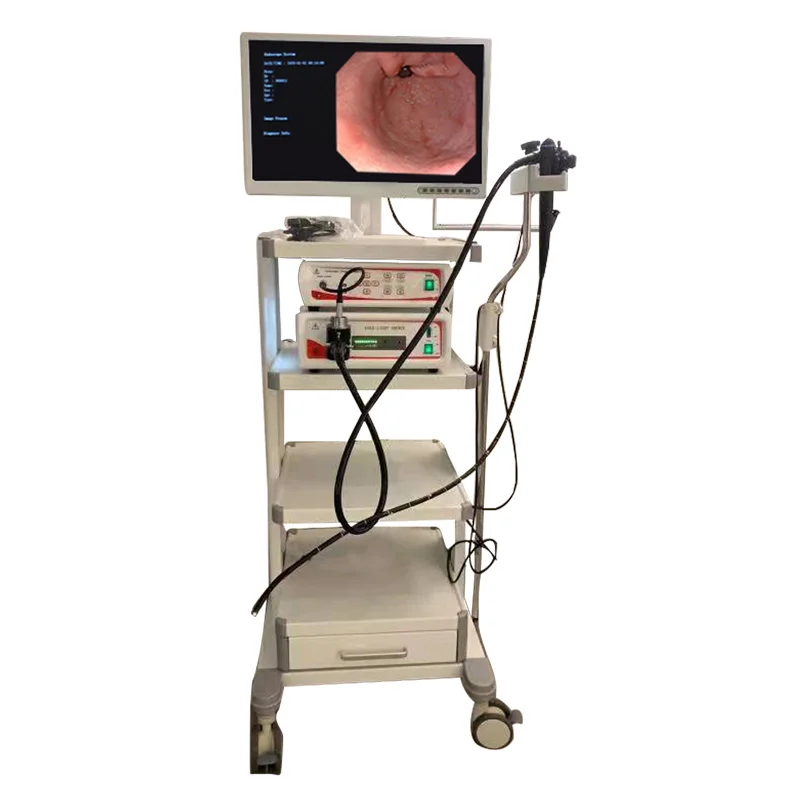 olympus endoscope Video Endoscopy Equipment Gastroscope and Colonoscope System portable 1080p  endoscopy camera supplier