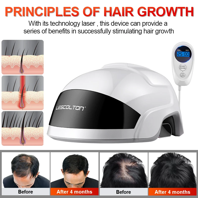 Lescolton Products Helps Grow Your Hair Helmet Lllt Professional Laser
