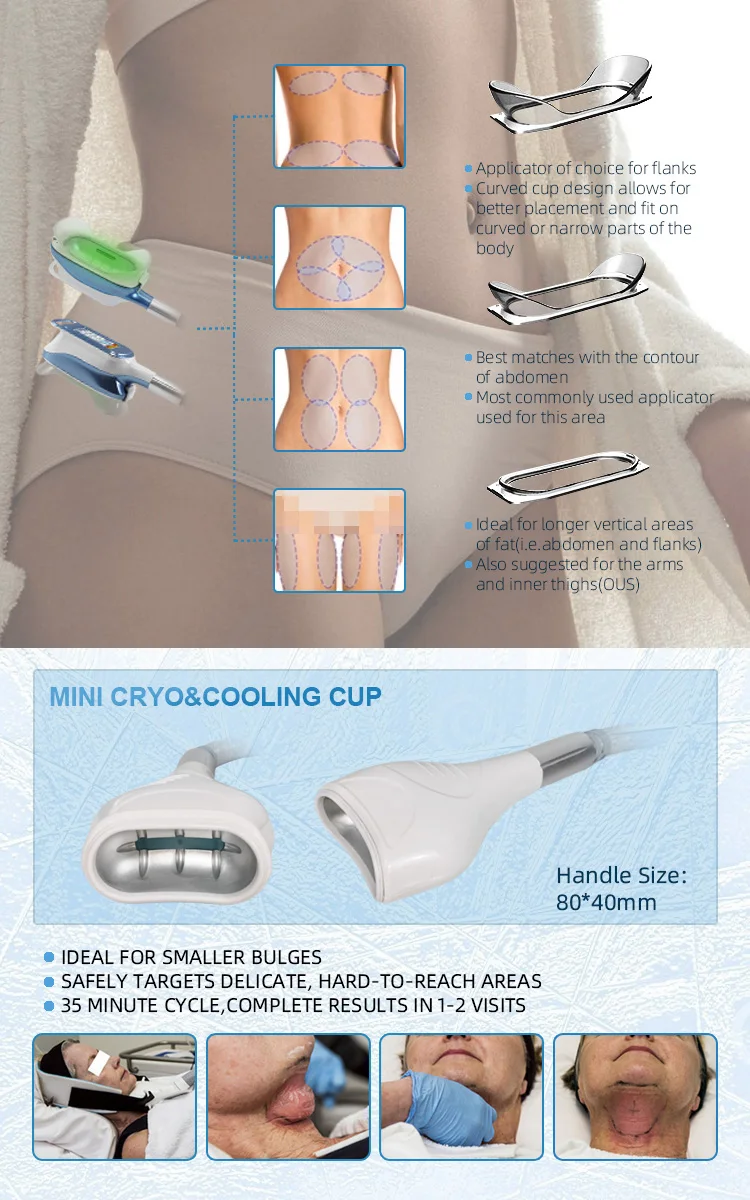 Fat Freezing Machine Cryolipolysis Slimming Machine 360 Cryolipolysis Slimming Machine Body Shape