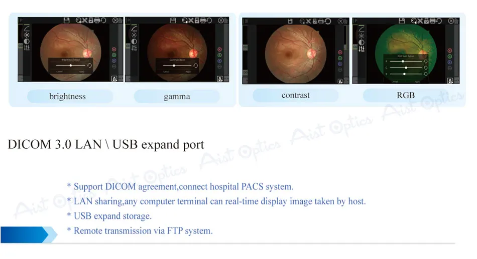 Reticam-3100 Ophthalmic Non-mydriatic Automatic Digital Retinal Fundus Camera
