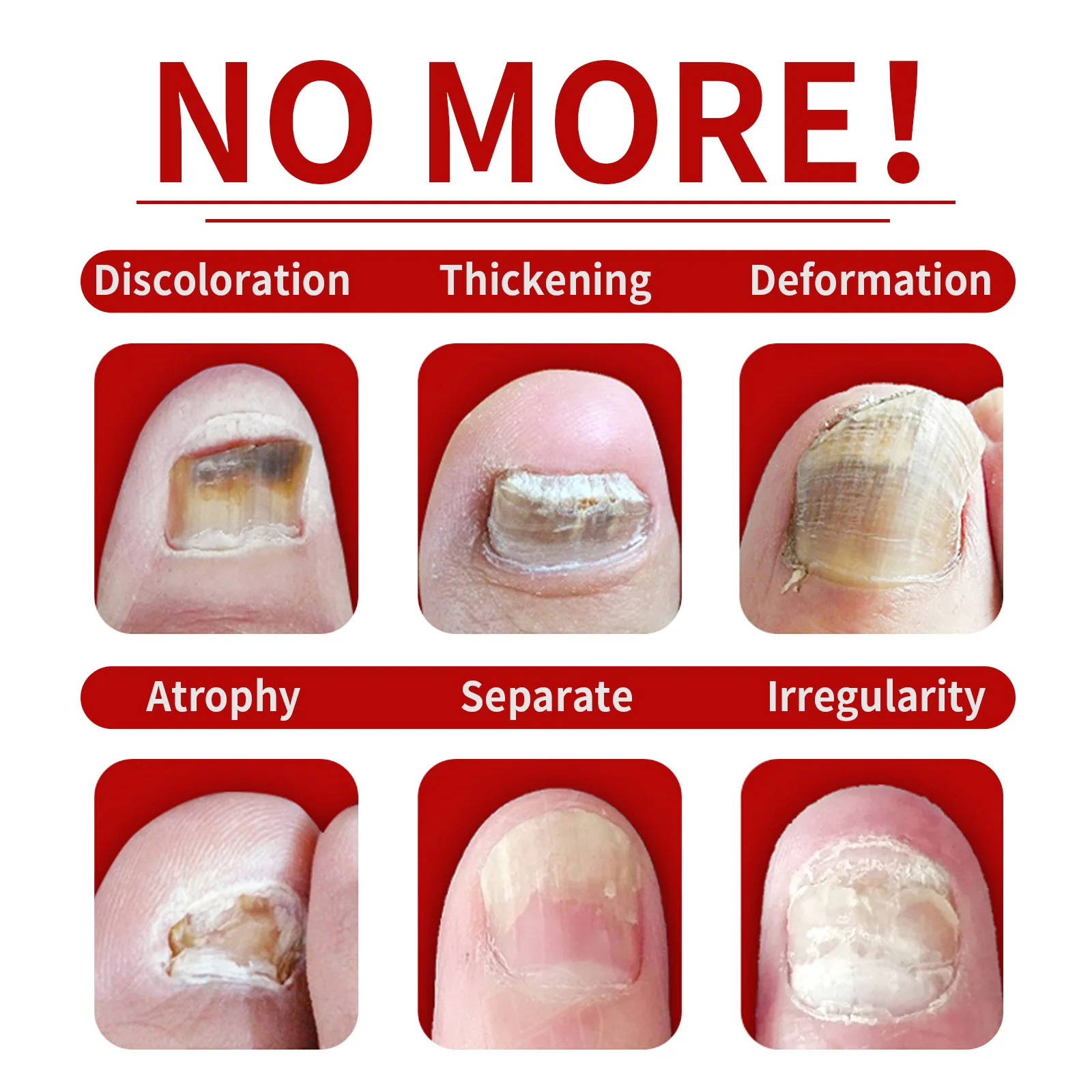 Jaysuing Soft Bright Grey Nail Repair Moisturizing Liquid Ginger Hand and Foot Care Product