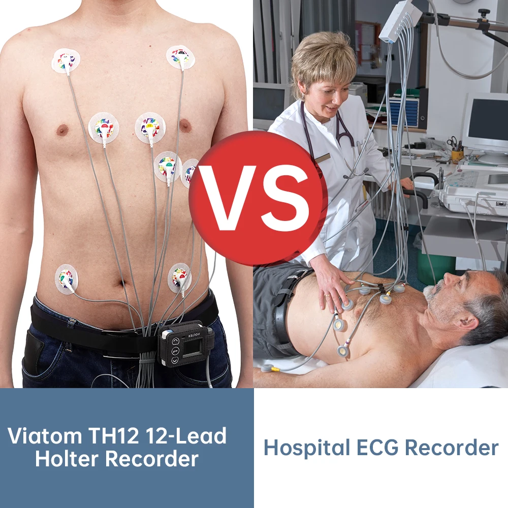 Th12 ai ECG Machine.