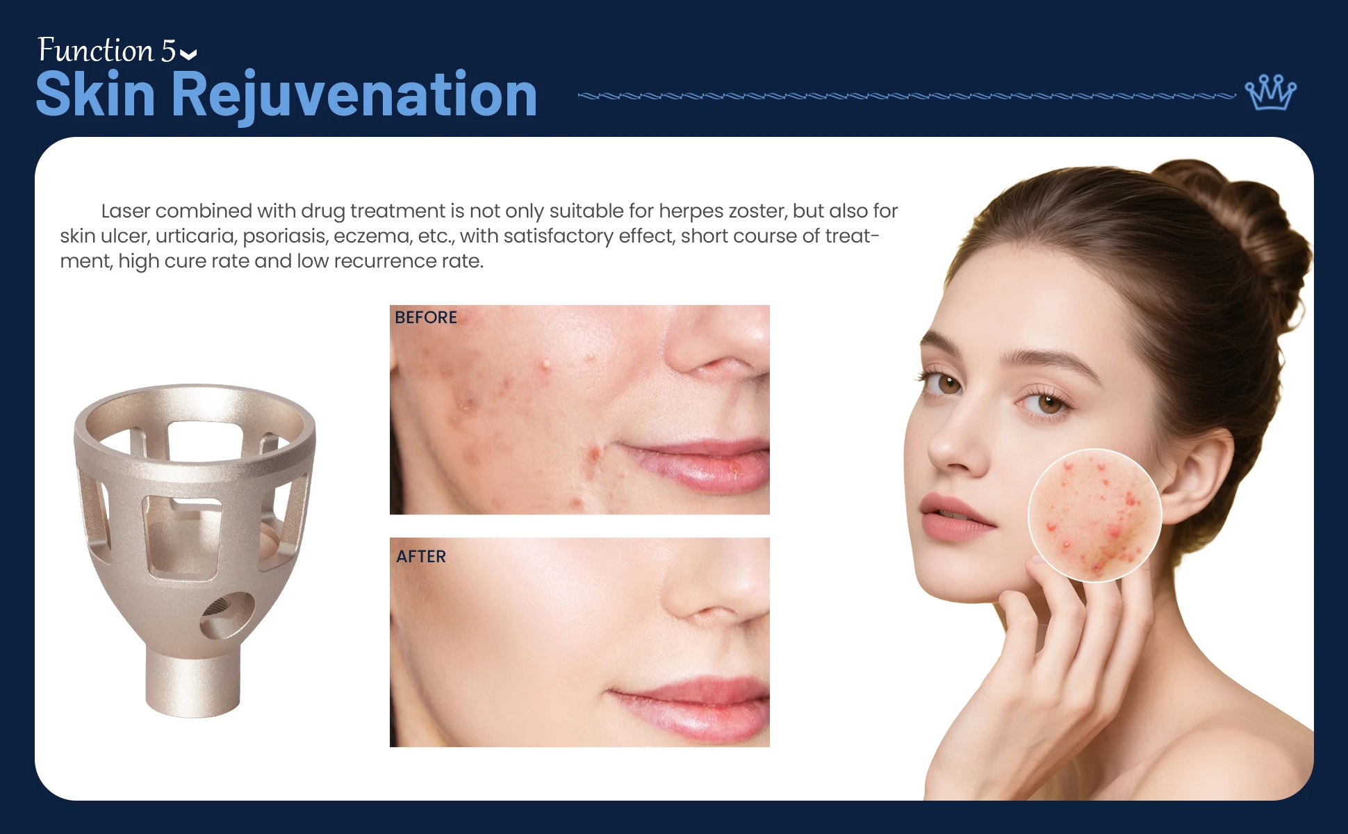 Skin Care Support