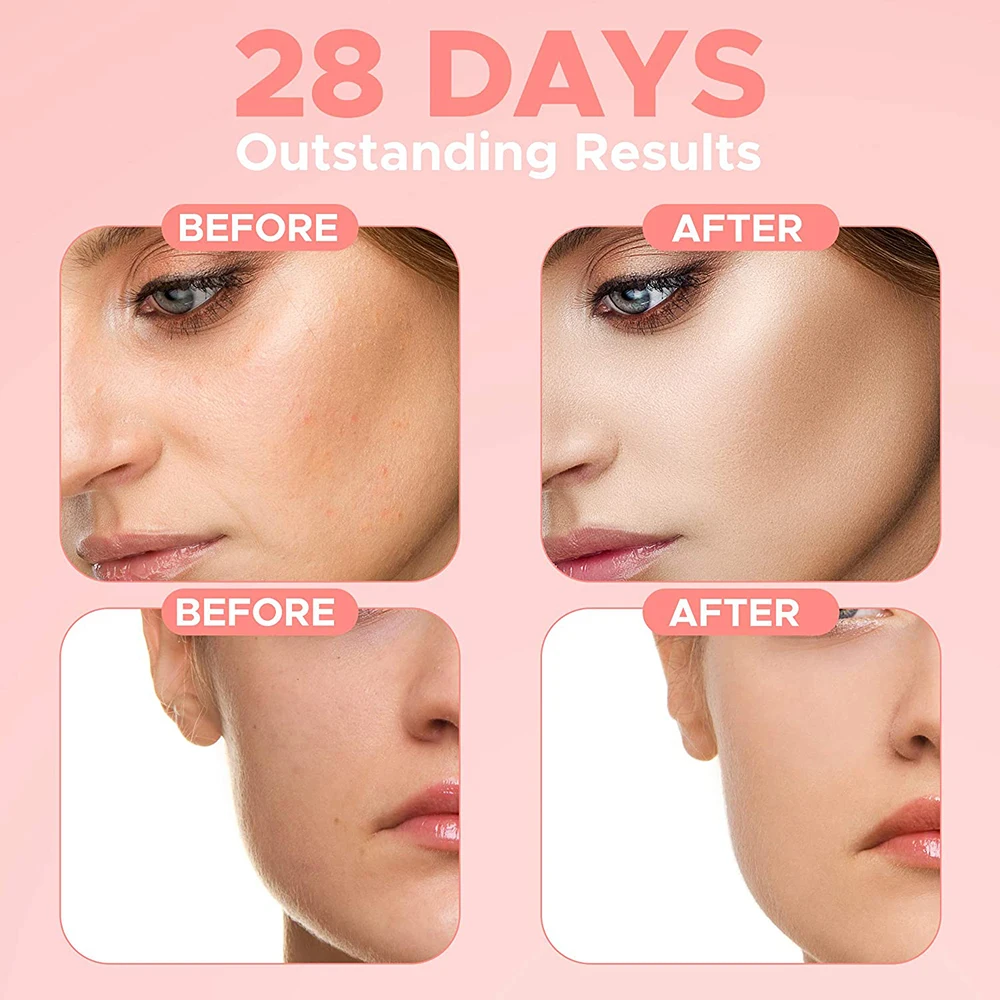 Deep Hydration Face Serum 4 in 1 Skin Care Set Kit Removing Dark Spots De Limpieza Anti Aging Whitening Facial Kit for Women Man
