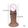 L-25*8,2-CM