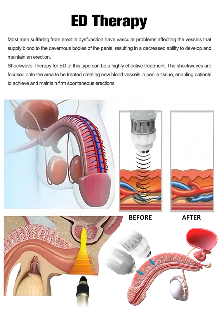 2025 Hot Selling Vibration Massage Weight Loss Electric Body Shaping Slimming Anti Cellulite With Vacuum Machine