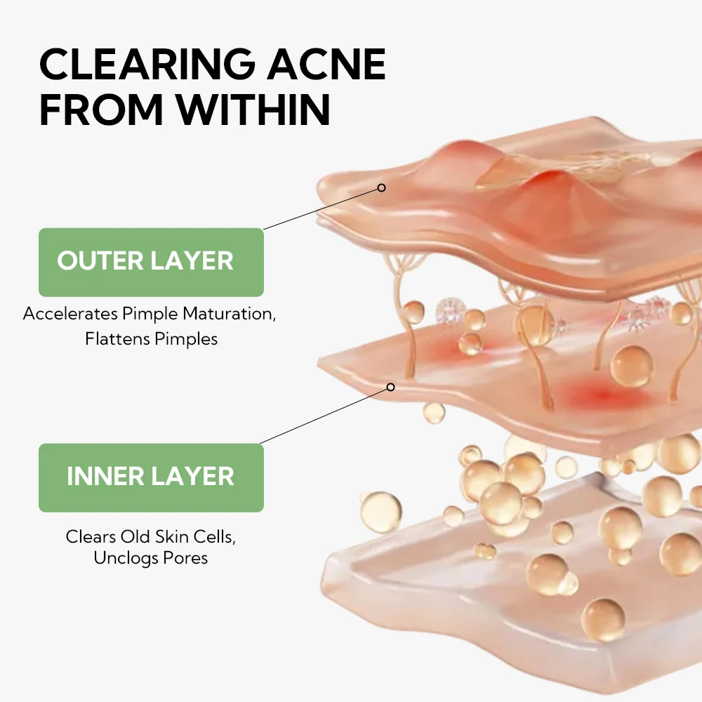 Lanbena Hot Sales Pore Reducing Face Minimizing Face Serum Anti Acnes Cream