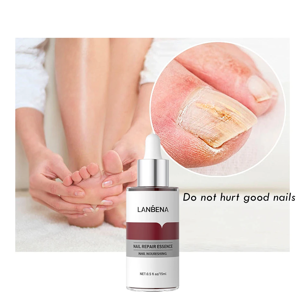 LANBENA Hot Sale Nail Essence Anti Fungus Nail Care Nourish Repair Serum
