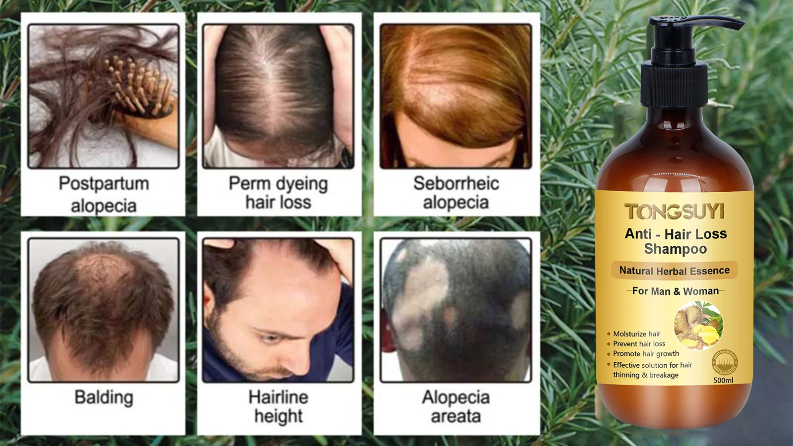 Customized Korean Herbal Treatment Product Shampoo Care Oem Hair Growth Anti Loss Shampoo For
