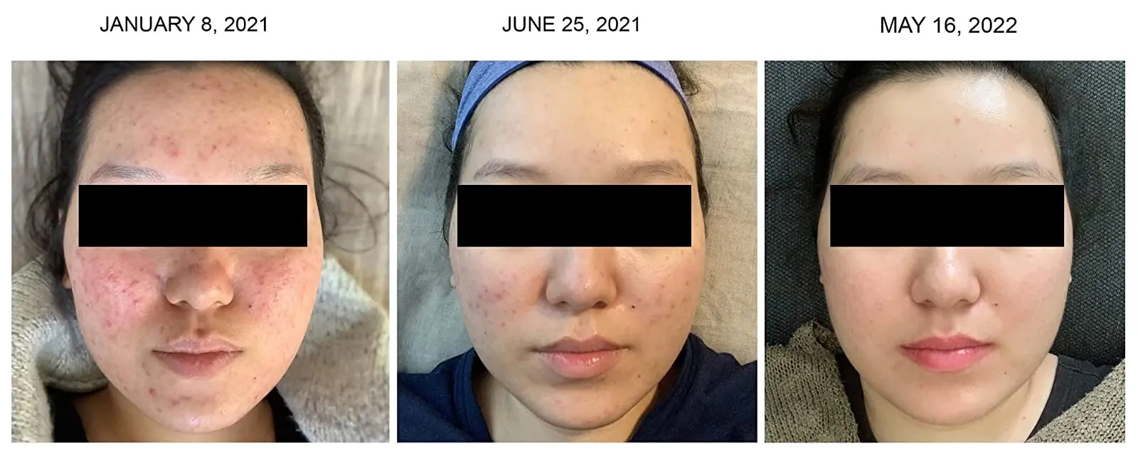 Flexible 7 Colors Led Light Therapy For Whole Body Skin Care Red Light