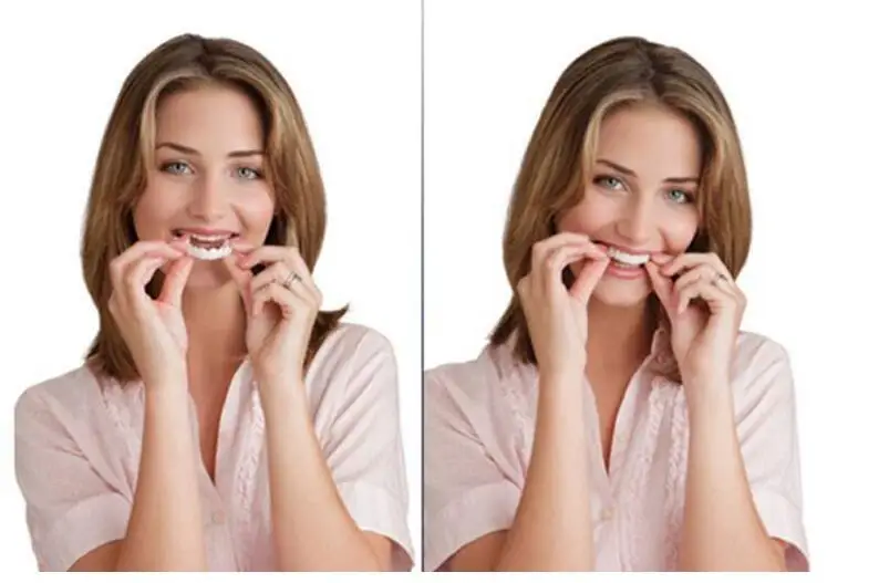 Snap Smile Customized  Label Upper and Lower False Teeth Cover Perfect Smile Veneers Comfort Fit Flex Denture Braces