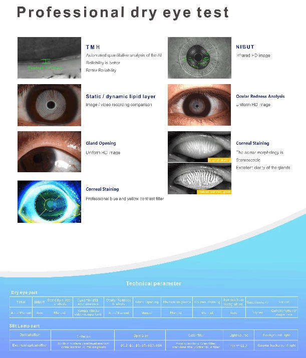 LS-5C Ocular Surface Analyzer with Digital Slit Lamp Dry Eye Examination Video Dry Eye Slit Lamp