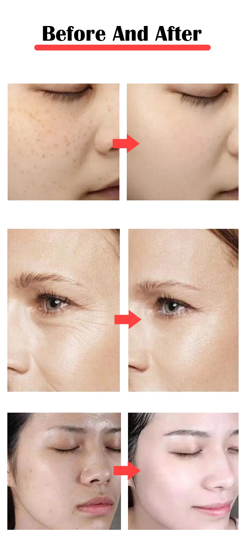 7 in 1 Oxygen Facial Machine Rejuvenation Anti Aging Hydro Dermabrasion Machine Skin Whitening Water Dermabrasion  