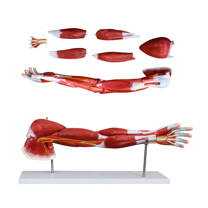 Upper Limb Muscle Arm Anatomy Model Detachable Arm Anatomical Model ...