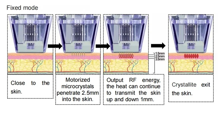 Discover a clinical-grade Microneedling RF System engineered for deep dermal remodeling, collagen stimulation, acne scar reduction, and skin tightening. Adjustable depth up to 7mm with precision RF delivery. Professional Fractional RF Microneedling Machine For Sale