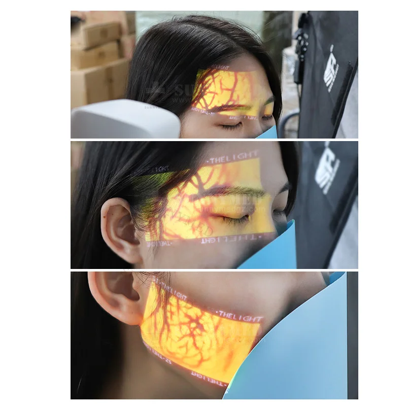 Cheapest Handheld Infrared Vein Finder Torch Handheld Vein Finder Price Intravenous Injection Locator Illuminator Vein Finder