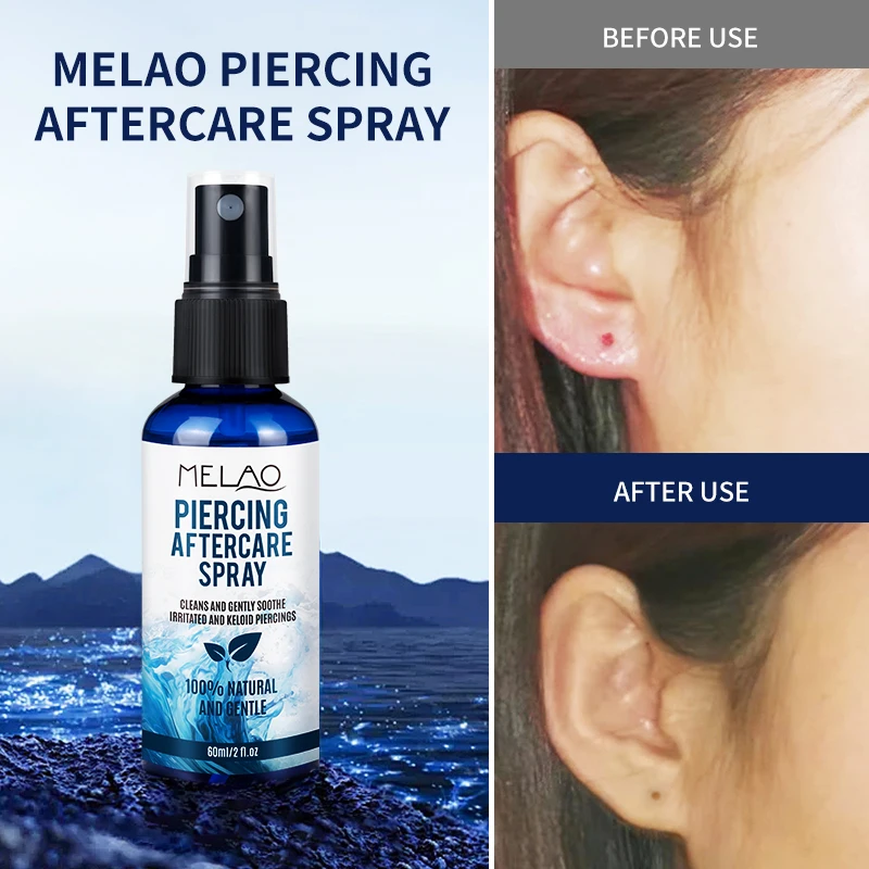 Organic Piercing Aftercare Spray Gentle Healing Sensitive Skin Natural  Piercing After Care Spray With Sea Salt & Aloe Vera