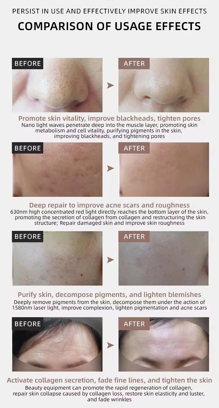 红光疗法面部按摩器，带7色发光二极管面膜，用于减少痤疮和防皱插件