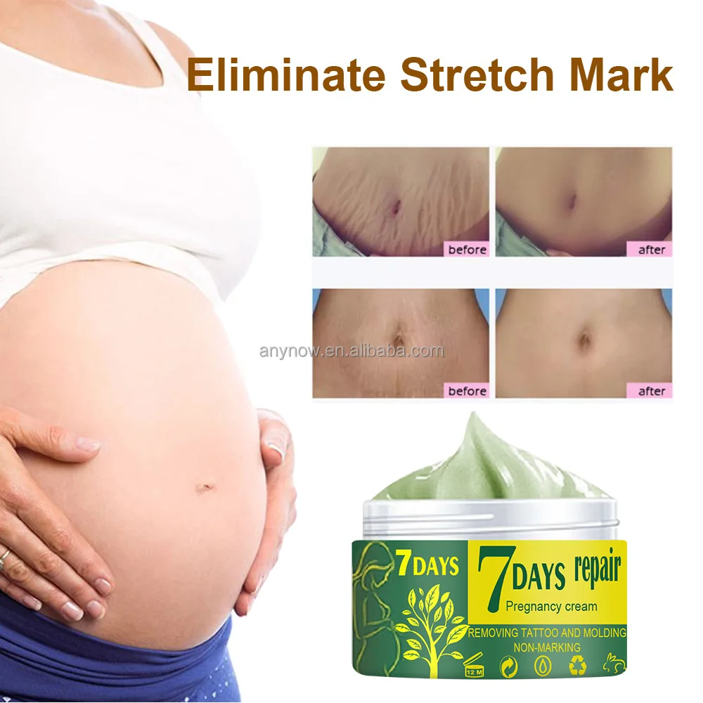  Stretch Marks Cream (7).jpg