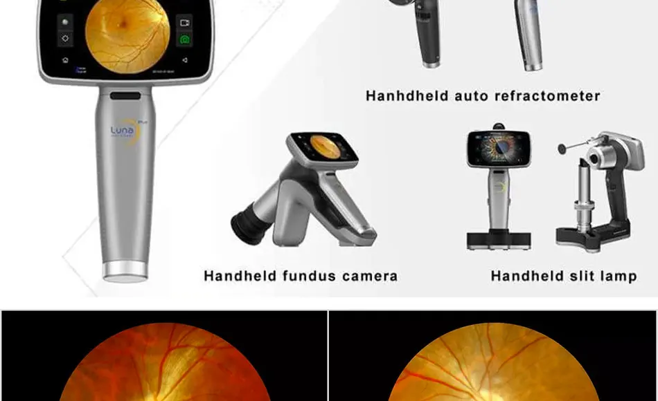 Rightway Brand  High Quality Automatic Portable Handheld Digital Eye Fundus Camera HFC-2