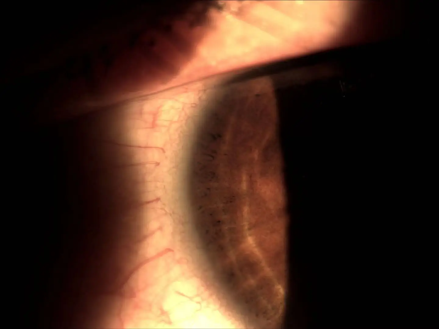 Professional Ophthalmic Module with Convenient Operation Slit Lamp Adapter for Optics Instruments