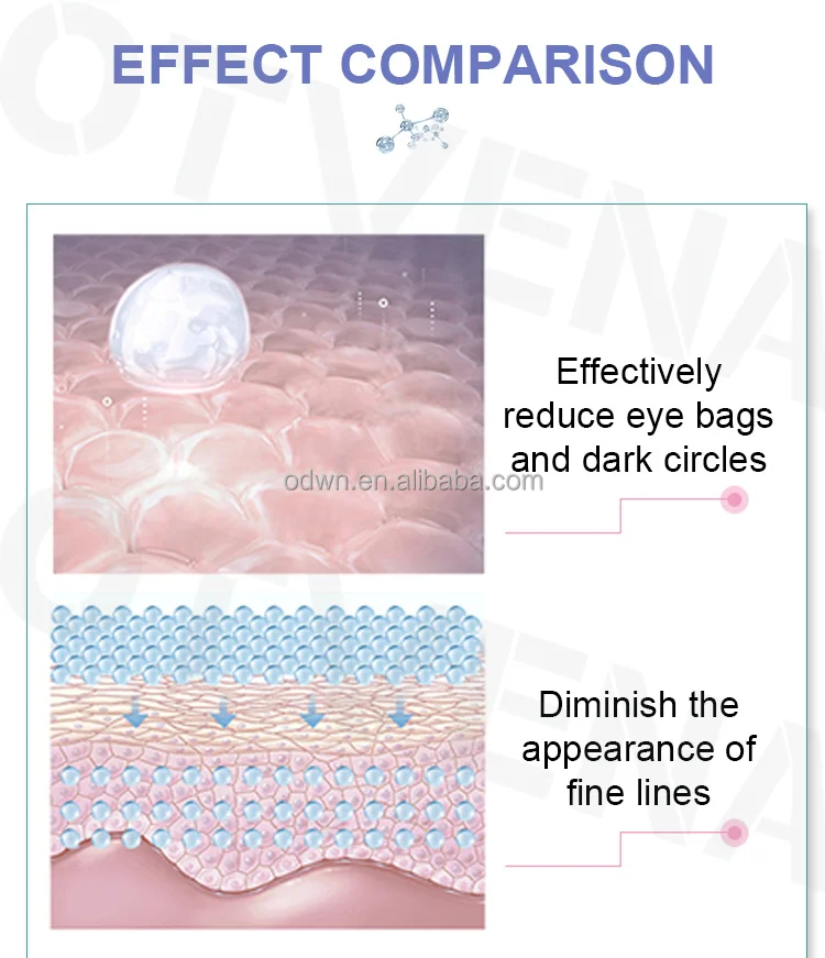 OTVENA Factory Customize Best 1ml Wrinkle Eye Bags Removal Under Eye Cream for Dark Circle and Puffiness