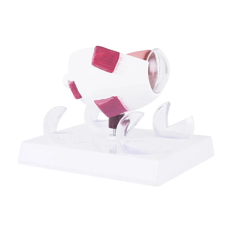 Ophthalmology Clinic Display Cornea Conditions Human Eye Demonstration Glaucoma Tool