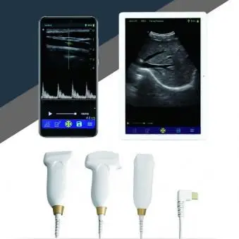 Intelligent Tablet 128 Elements Black and White Handheld Wireless Ultrasound Scanner MSLMU07