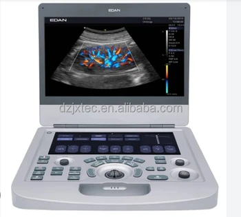 Edan Ax3 VET Portable Color Doppler Ultrasound Scanner with Convex/Linear/Cardiac Phased Array Transducer