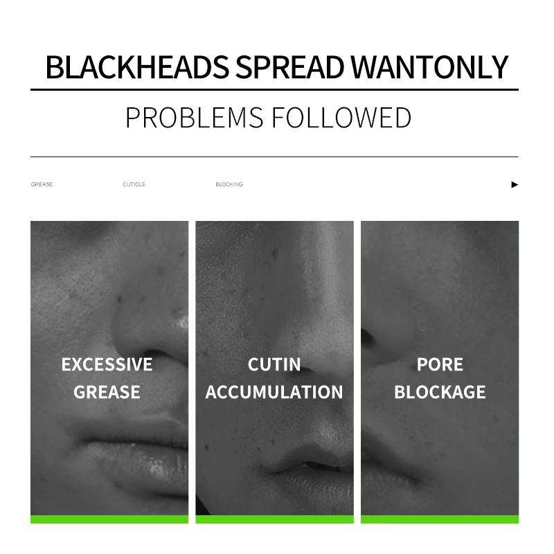 KORMESIC Charcoal Deep Cleansing Peel Off Blackhead Remover Whitening Black Skin Care Clay Blackhead Nose Facial Mask