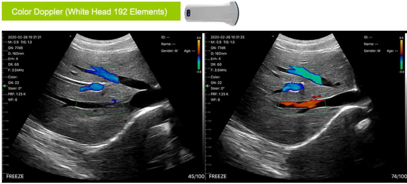 OEM Double Head Linear Small Linear Micro Convex Portable Wireless Mobile Phone Ultrasound Scanner