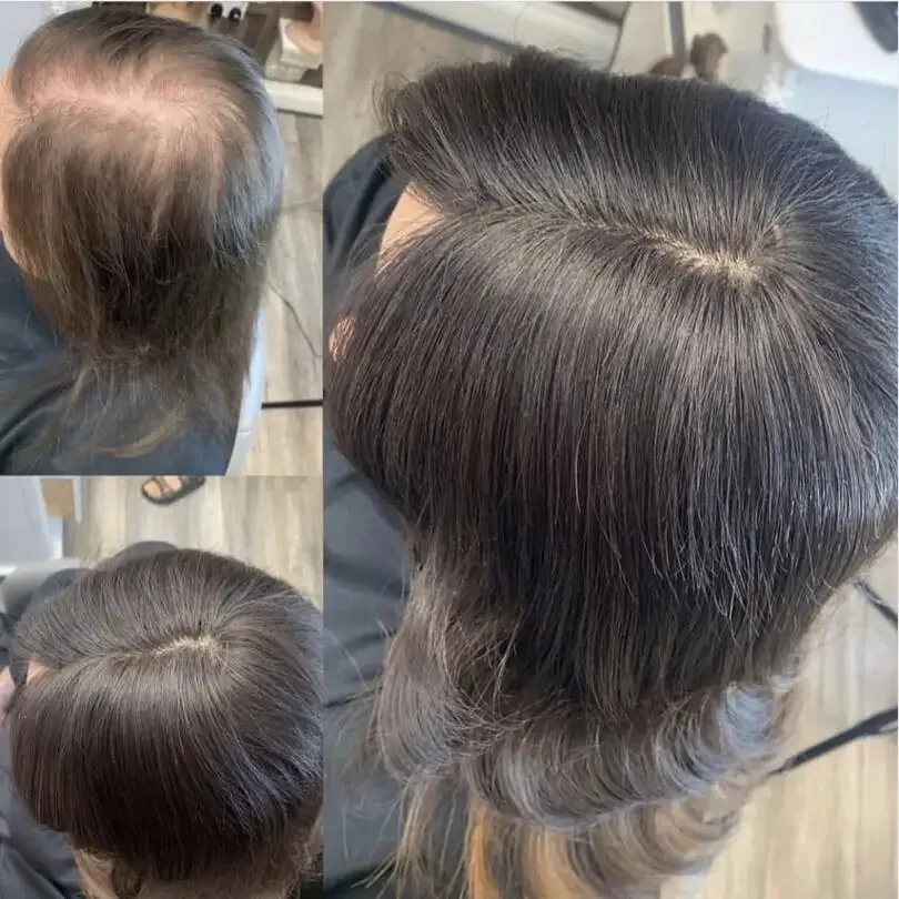 6x6 pouces Base de soie Topper pour femmes européen brun lâche vague cheveux humains vierges postiche respirant 2CM PU_voghion.com