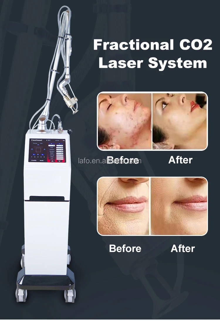 CE Approved l Tightening Facial Skin Rejuvenation RF Tube Fractional Co2 Laser Machine