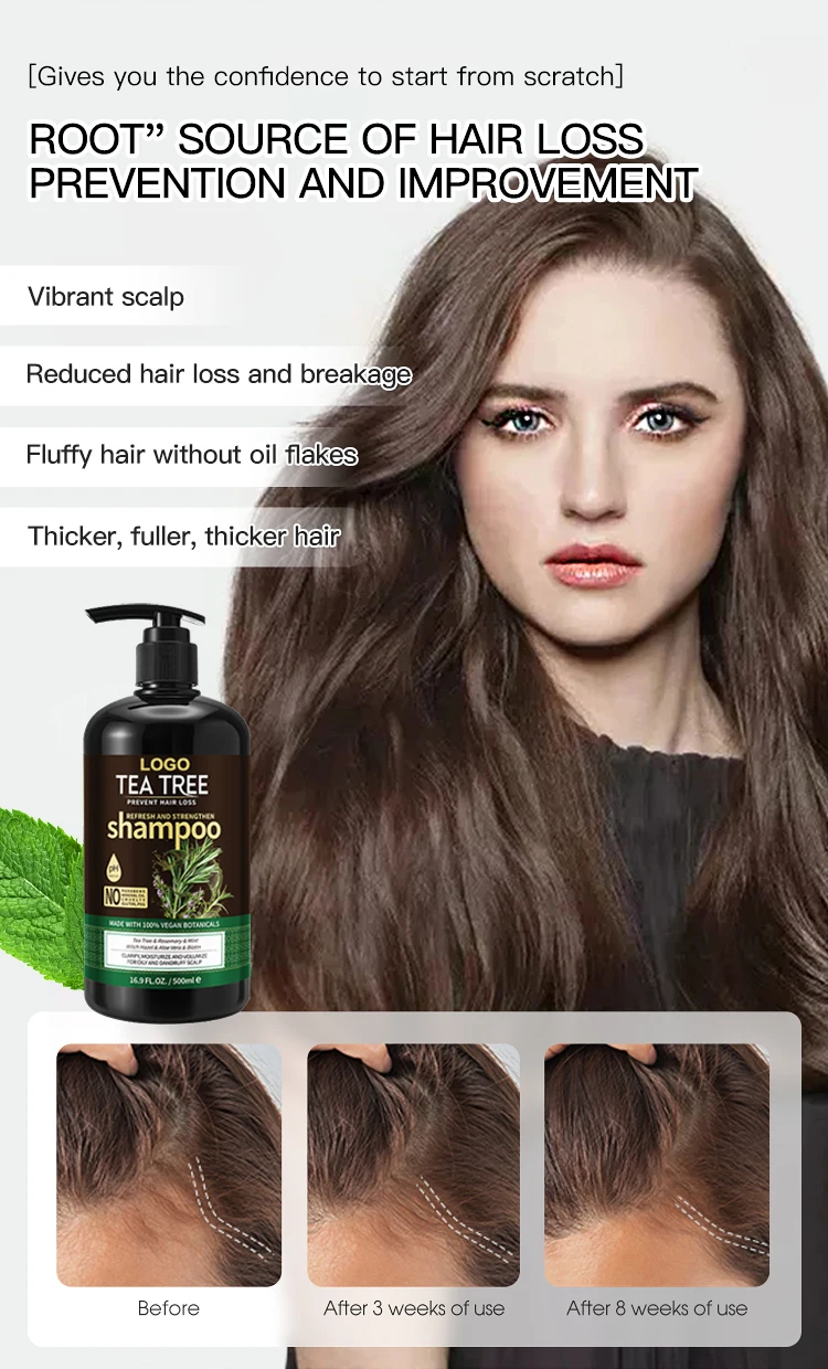 Customized Anti Dandruff Shampoo Organic Tea Tree Keratin Anti Hair